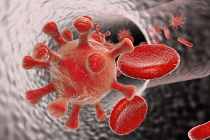 Symptoms of HIV/AIDS.